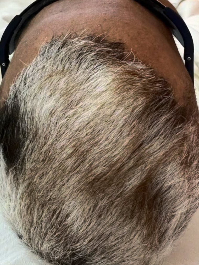 A mesma região depois do acompanhamento.